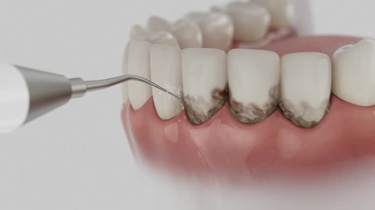 Reliable Dental Implants contractor in Hillcrest, CA by Smile Center Dentistry